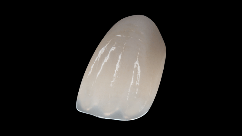 Coronas de Zirconio